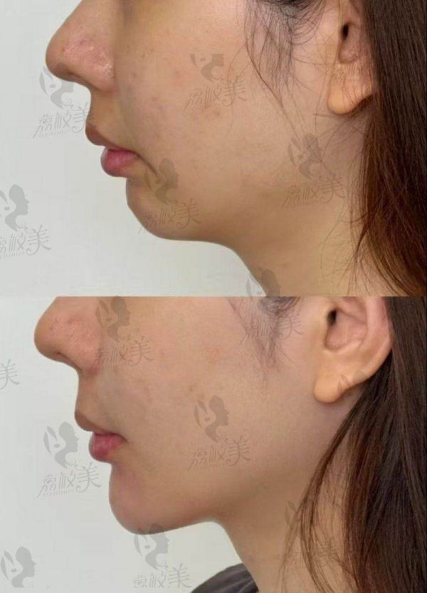 江油白天鹅整形医院怎么预约？