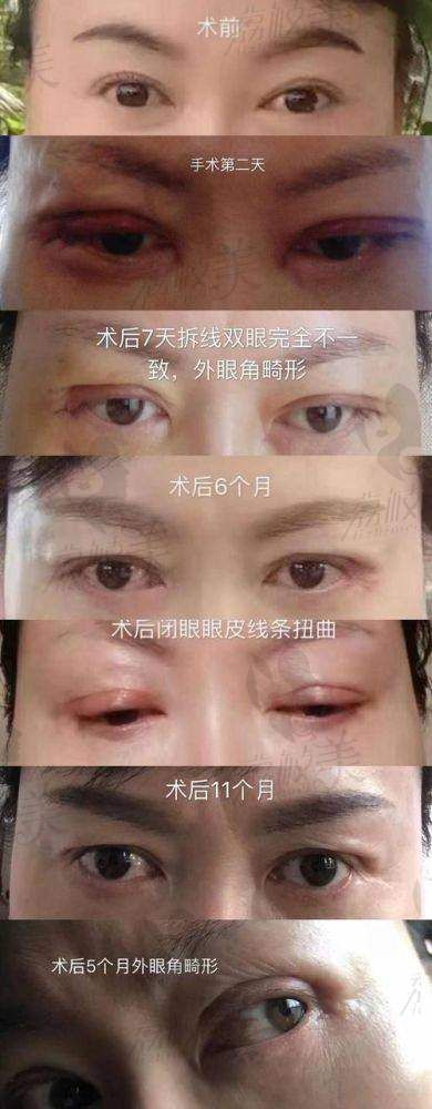 江油白天鹅整形医院价格表（仅供参考）