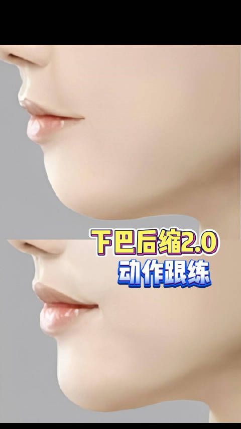 下颌短缩影响颜值与健康，矫正动作改善面部轮廓