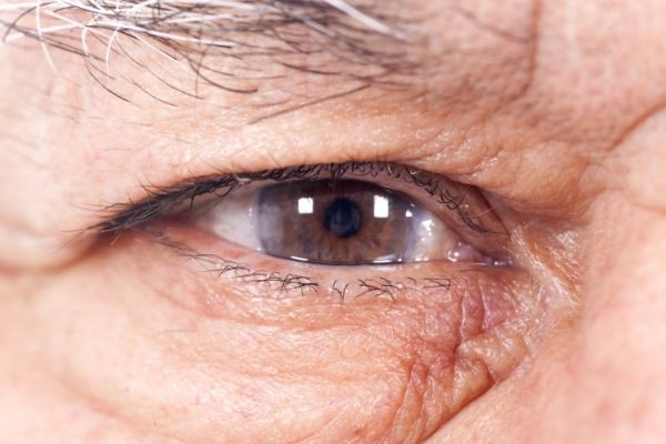 怎治疗白内障？从诊断到康复的全过程指南