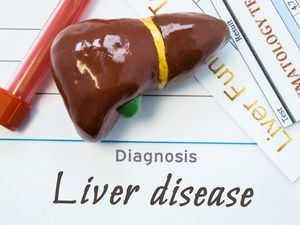 吃保健品肝功能异常吗肌酸激酶高