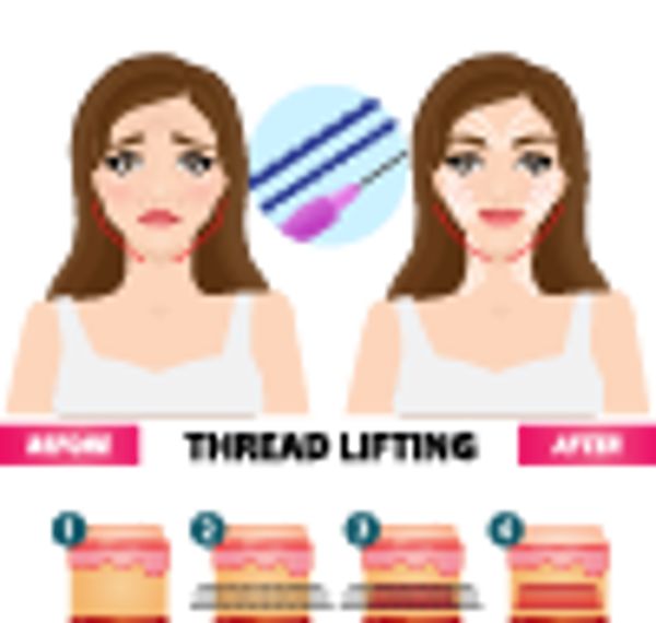 怎么大量抽脂瘦脸减肥