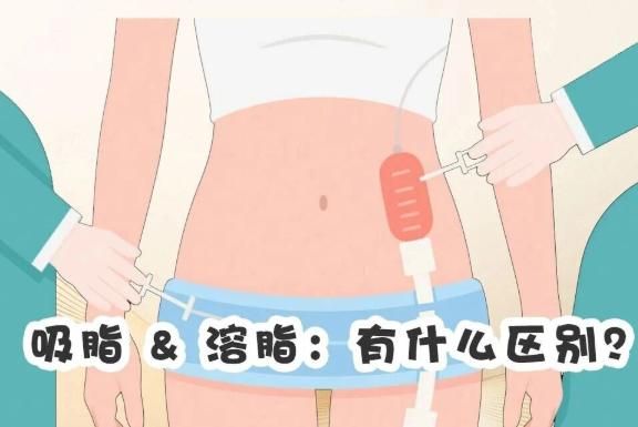 二、2026年张怀军吸脂价格表