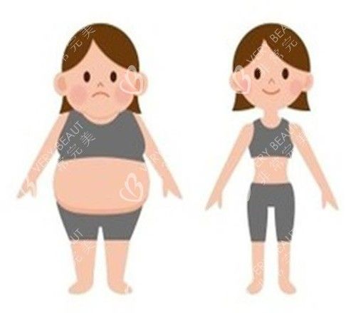 吸脂前后示意图