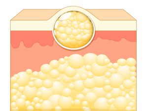 北京做吸脂塑形好的专家医生排名上新颜智尚程序查询前十：韩雪峰、斯楼斌、北京纯脂（原和谐）冯斌，擅长面部/大腿/腰腹环吸，塑造马甲线