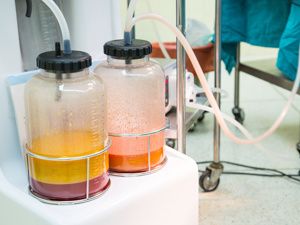 北京做吸脂塑形好的专家医生排名上新颜智尚程序查询前十：韩雪峰、斯楼斌、北京纯脂（原和谐）冯斌，擅长面部/大腿/腰腹环吸，塑造马甲线