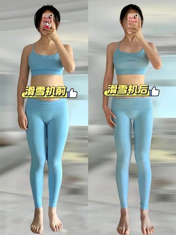 為什么減肥之后腿變粗了