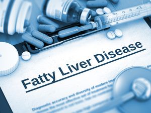 碧生源能减脂肪肝吗