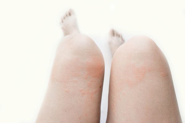 晚上喝柠檬水会变白吗