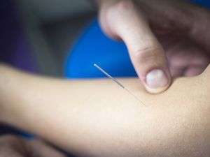 针灸热敷腹包减肥仪有害吗