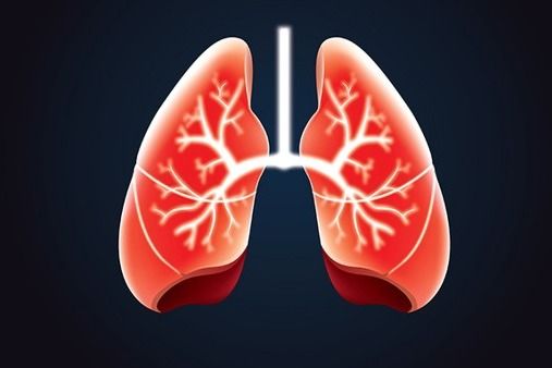 肺癌早期有三处痛请注意 早发现能救命