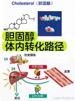 分娩方式