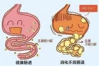 婴儿肠绞痛的最新评估标准与护理方案（推荐收藏）