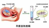 羊水穿刺，做or不做？