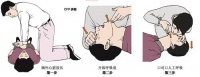 家庭急救与护理知识