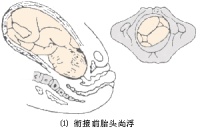 分娩时，胎儿是怎样通过产道？