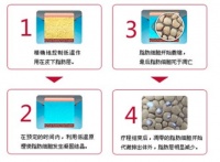 爱瘦国际体重管理中心