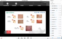 临床医学院举办“青春无‘瑕’——皮肤护理与养发护发”线上健康知识讲座