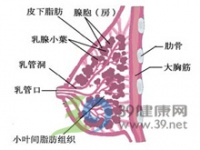 胸部外扩下垂用内衣矫正吗？