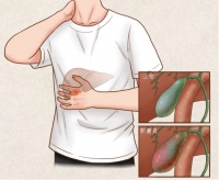 保护肝胆从良好生活习惯做起