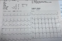 规培生接急诊心梗，主任听完医嘱后惊呆了，站友：漏了一件最重要的事