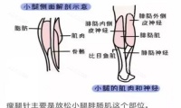 瘦腿攻略!瘦腿针真的能瘦腿吗?瘦腿针一次打多少量?建议小白来看