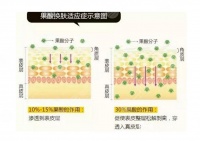 果酸的作用和功深层解读！多少钱一次？能维持多久？