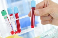 血脂高伤全身，生活中如何降血脂