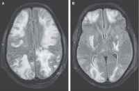 微信里刚学过的病，门诊就见到了