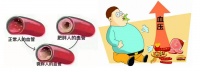 【科普园地】 减脂与高血压心血管保护：健康生活的关键