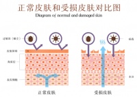 健康皮肤屏障和受损皮肤屏障对比