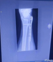 基层医生独自做手术，却被同行怒批：无菌观念在哪？