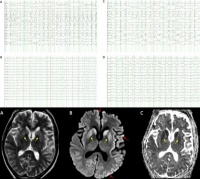 老年男性出现被害妄想，会诊看到病人我惊呆了