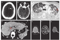 怀疑患者是狂犬病，我被主任批评：一元论白学了