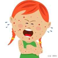 朱丹 40 余年鸡蛋“误吃史”：过敏背后的健康启示与生活省思