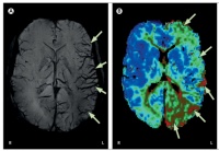 年轻小伙突然说不出话 1 小时，医生却说：不用治