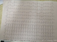 34 岁老师入院半小时抢救无效死亡，死因为何？