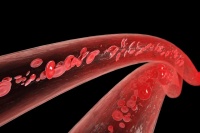 管理好生活细节 血管更健康