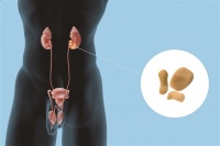 科学网—预防泌尿系统结石，健康生活方式很重要