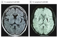 患者拿笔时会不自主张口，这个病你能一眼秒杀吗？