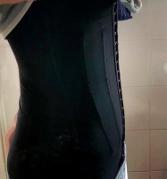 腰腹吸脂，取悦自己的新选择