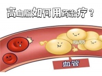 立普妥的副作用有哪些？一文为你详解高血脂用药那些事