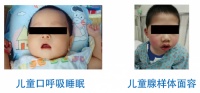儿童腺样体面容防控新方案：清雷科技创新医疗器械守护黄金睡眠