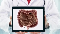 医生发现：一旦出现这4种症状，或暗示肠道里有息肉，赶紧去检查