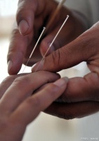 针灸：传统医学的秘密武器，开启健康生活新方式