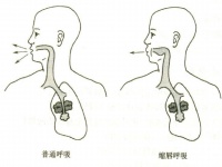 COPD患者健康教育