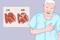 房颤自我恢复锻炼