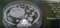 患者 CT 驚呆整個科室！醫(yī)生急呼：妥妥的醫(yī)療事故