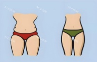 德國(guó)Body