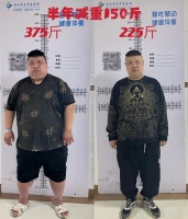 胖友们的福音！半年减重150斤！减重手术带你享“瘦”好生活